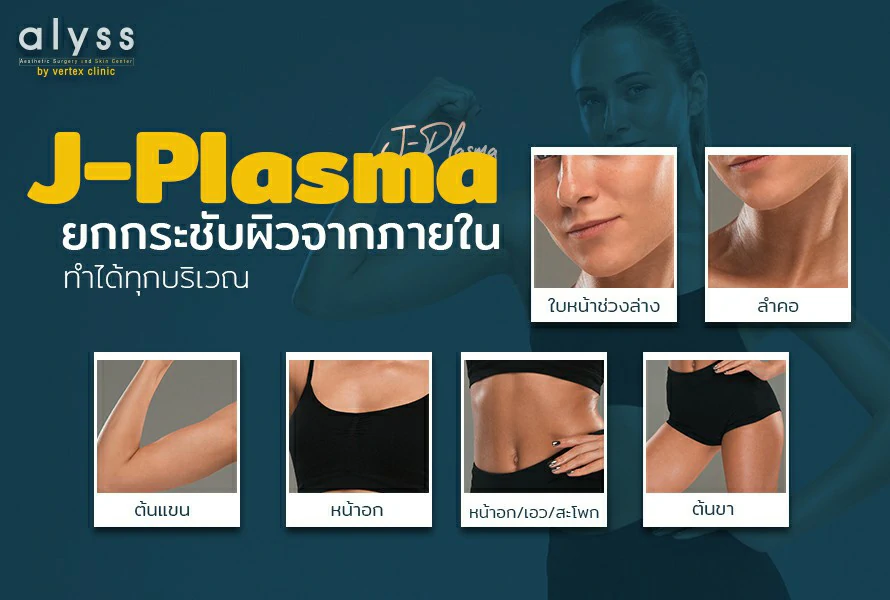 J-Plasma