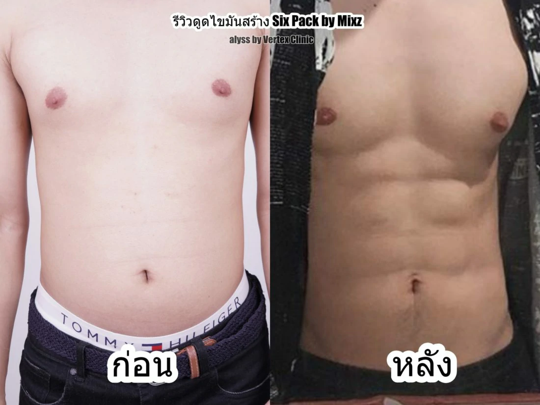 Review-Sixpack-Panupong
