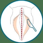 icon-labia