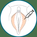 icon-labia