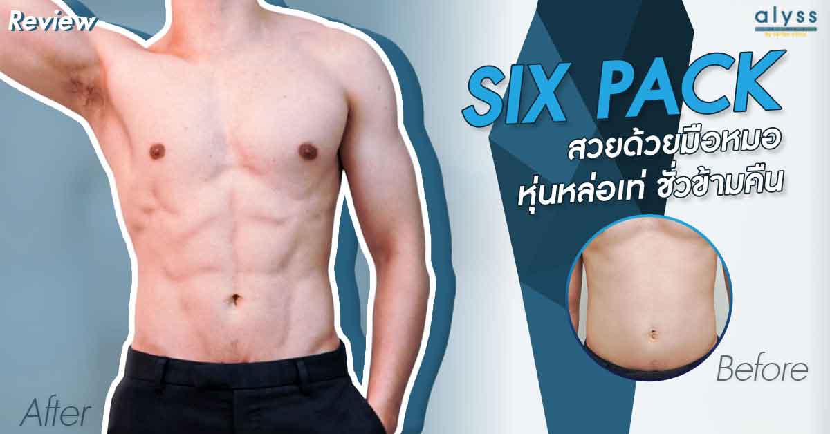 [รีวิวดูดไขมัน] ดูดไขมันสร้าง Six Pack ปั้นซิกแพคสวยด้วยมือหมอ