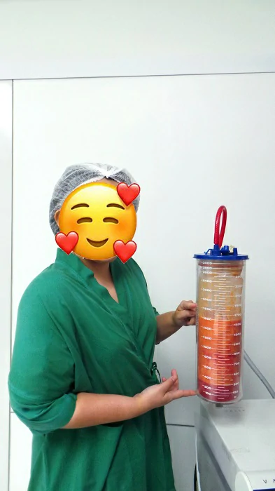 ดูดไขมันต้นแขน-รีวิว-ดูดไขมันแขน-รีวิว