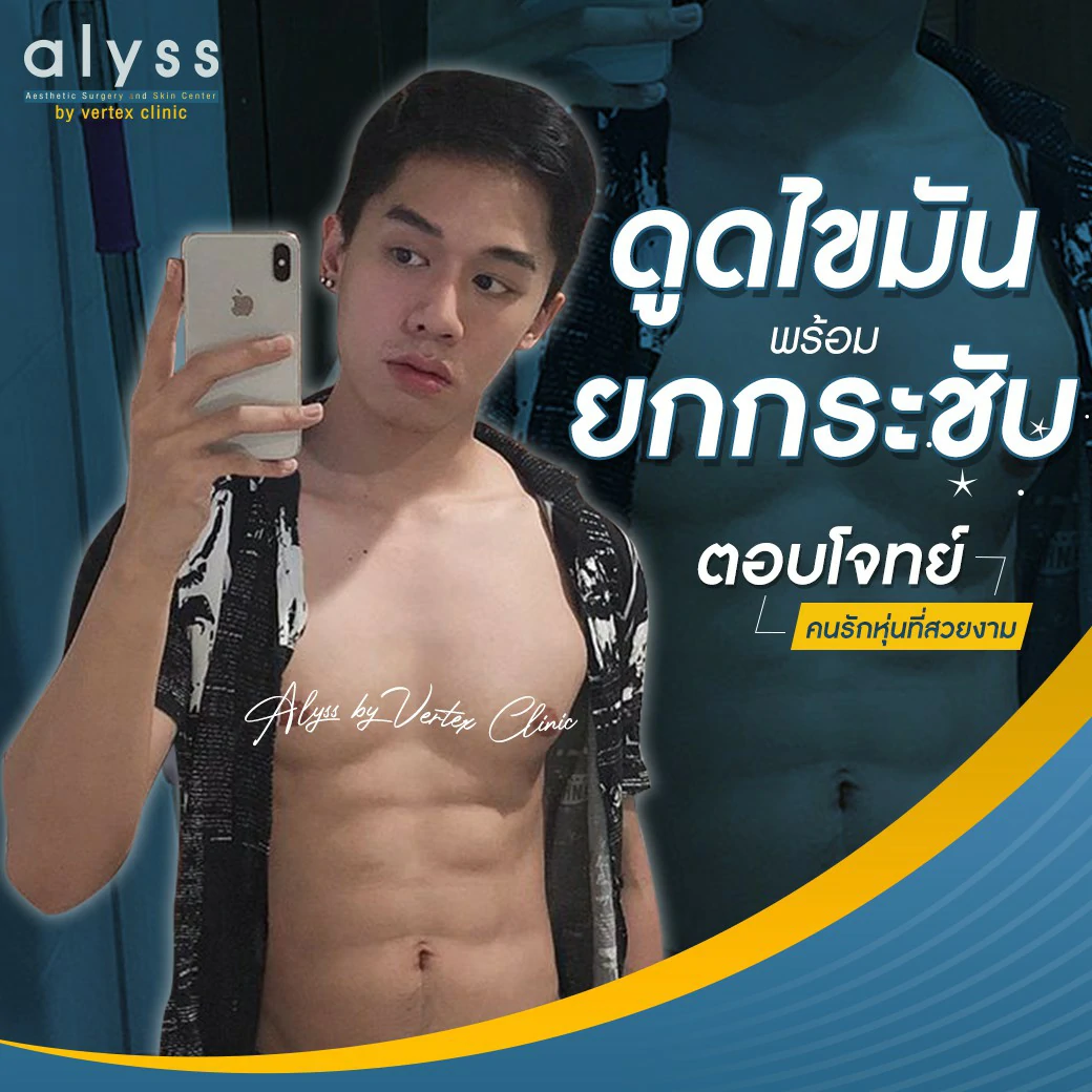 ดูดไขมันพร้อมยกกระชับ