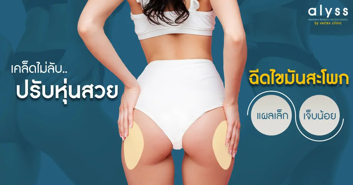 รีวิว-ฉีดไขมันสะโพก-ก้นสวย