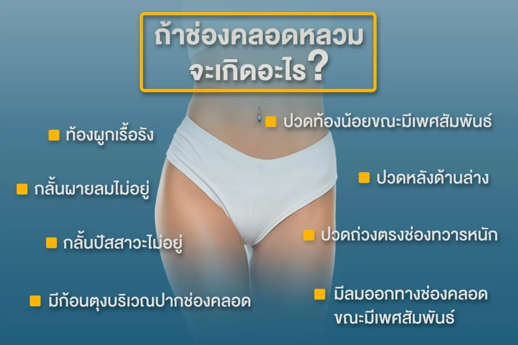 รีแพร์กระชับช่องคลอด