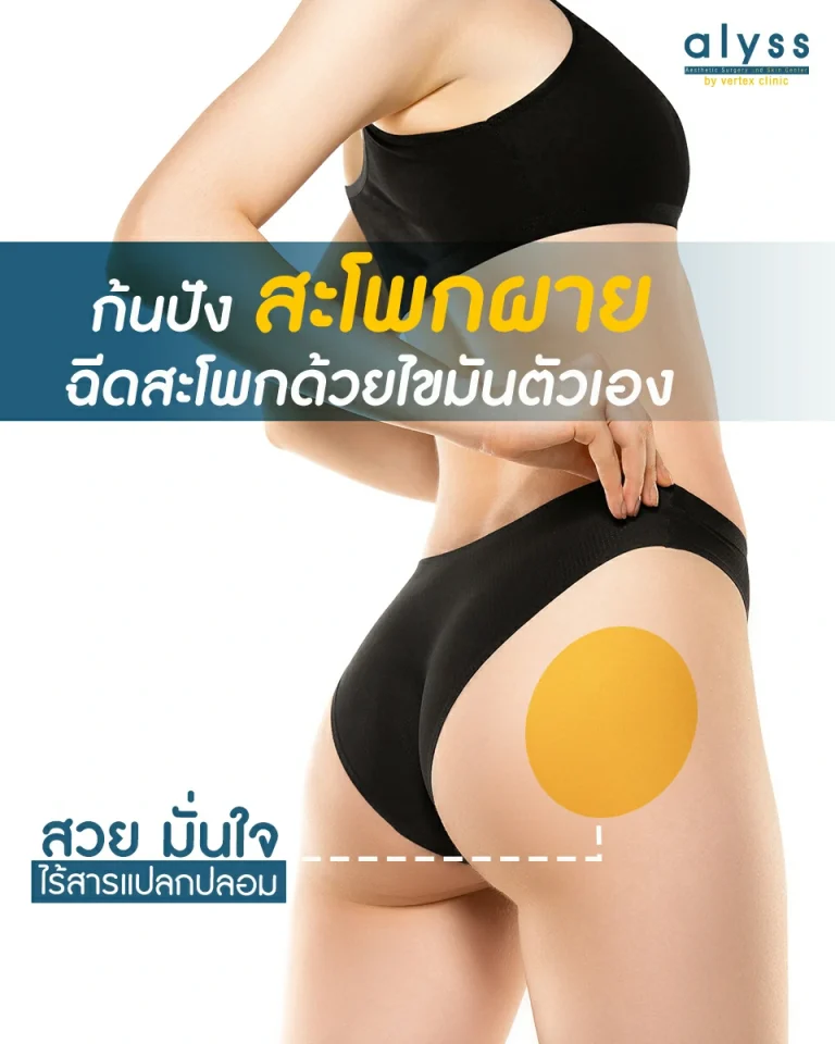 เสริมสะโพกปัง-ฉีดไขมันเสริมสะโพก
